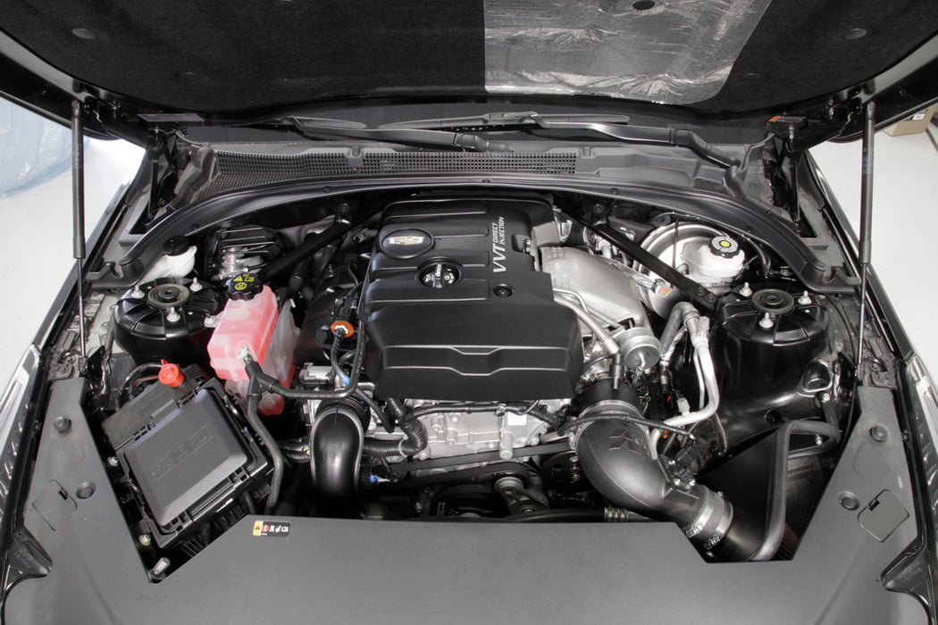 K&N 57-3100 Engine Cold Air Intake Performance Kit - Truck Part Superstore
