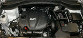 K&N 63-5301 Engine Cold Air Intake Performance Kit - Truck Part Superstore