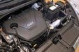 K&N 69-5304TS Engine Cold Air Intake Performance Kit - Truck Part Superstore