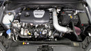 K&N 69-5317TS Engine Cold Air Intake Performance Kit - Truck Part Superstore