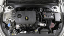 K&N 69-5322TS Engine Cold Air Intake Performance Kit - Truck Part Superstore
