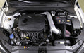 K&N 69-5323TS Engine Cold Air Intake Performance Kit - Truck Part Superstore
