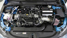 K&N 69-8758TS Engine Cold Air Intake Performance Kit - Truck Part Superstore
