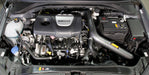 AEM Induction 21-817C Engine Cold Air Intake Performance Kit - Truck Part Superstore